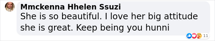 Jessica, A Model With Down Syndrome, Is Shattering Beauty Standards And Paving The Way For Others Jessica, A Model With Down Syndrome, Is Shattering Beauty Standards And Paving The Way For Others