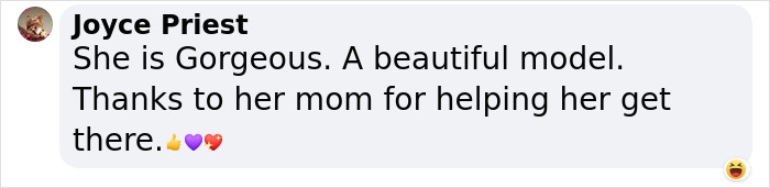 Jessica, A Model With Down Syndrome, Is Shattering Beauty Standards And Paving The Way For Others Jessica, A Model With Down Syndrome, Is Shattering Beauty Standards And Paving The Way For Others