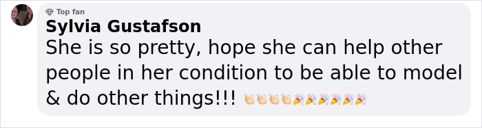 Jessica, A Model With Down Syndrome, Is Shattering Beauty Standards And Paving The Way For Others Jessica, A Model With Down Syndrome, Is Shattering Beauty Standards And Paving The Way For Others