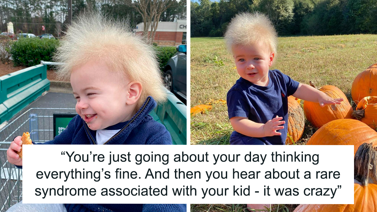 Happy Toddler Diagnosed With Uncombable Hair Syndrome Shows There Is No Such Thing As A Bad Hair Day