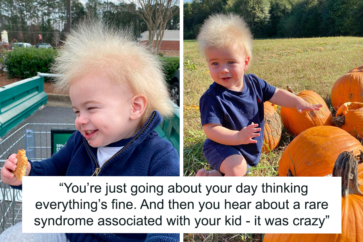 Happy Toddler Diagnosed With Uncombable Hair Syndrome Shows There Is No  Such Thing As A Bad Hair Day | Bored Panda