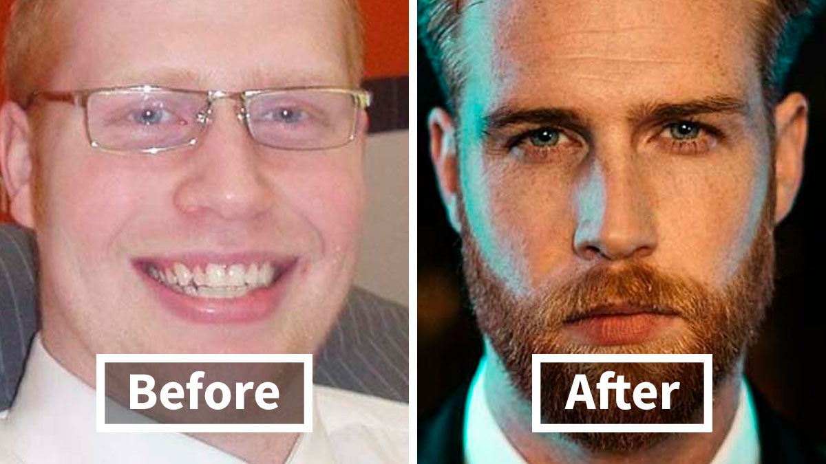 30 Men Who Are Now Rocking A Bearded Look Share How They Looked Before