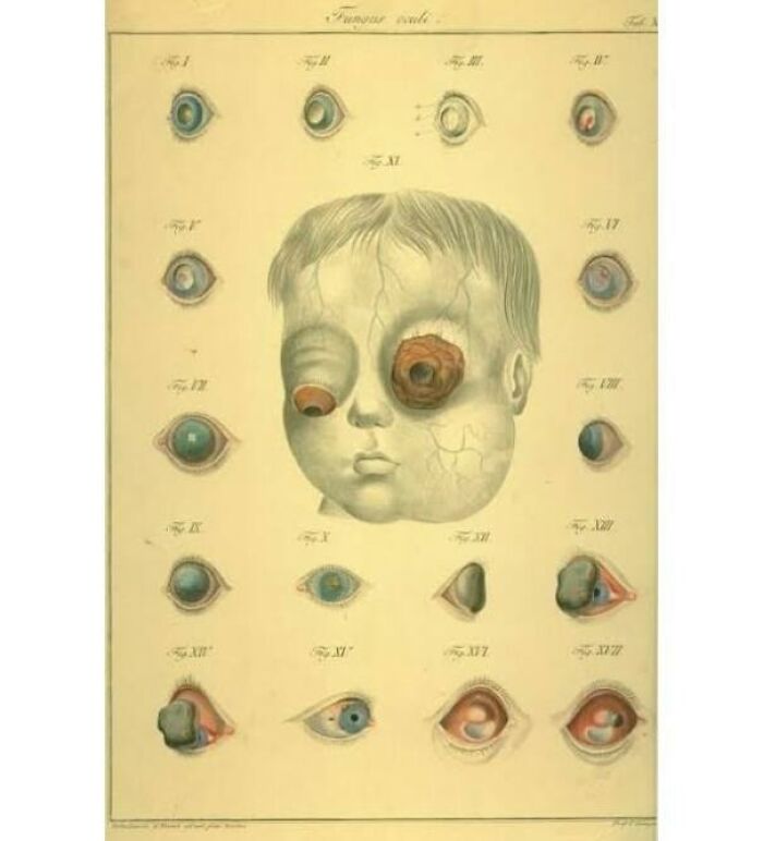Need A Fresh New Look? 19th Century 'Fungus Oculi' Illustration Showing Off All The Hottest Eye Fungus Looks This Season