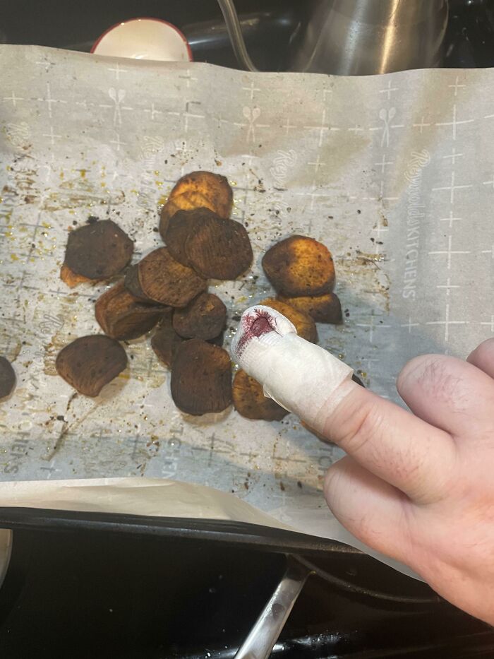 I Sliced The Tip Of My Finger Off Making Sweet Potato Chips And Then I Burned The Chips