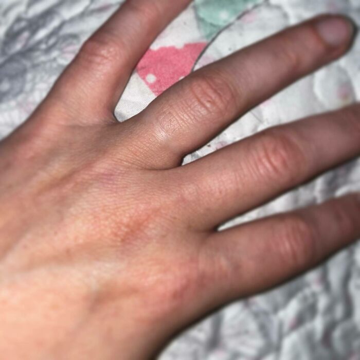 Tonight After A Full-On Hormonal Breakdown, I Took My Wedding Ring Off So That My Fingers Can Get All Fat While I’m Carrying Our Baby
