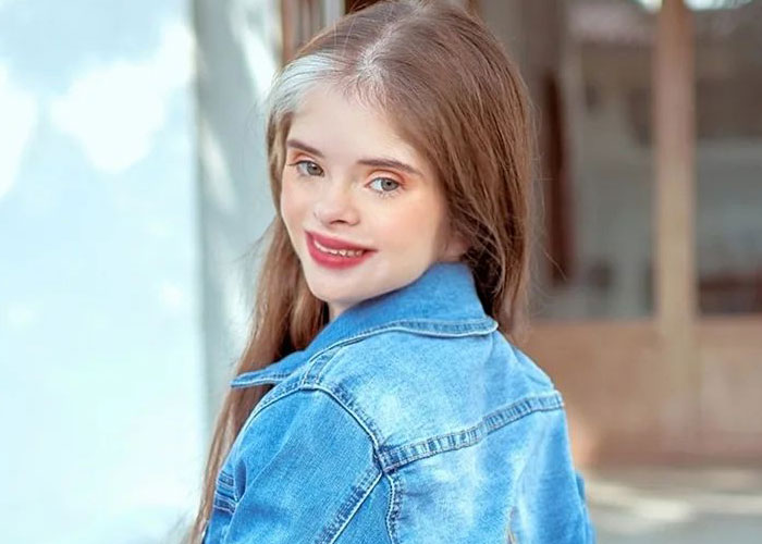 Jessica, A Model With Down Syndrome, Is Shattering Beauty Standards And Paving The Way For Others Jessica, A Model With Down Syndrome, Is Shattering Beauty Standards And Paving The Way For Others