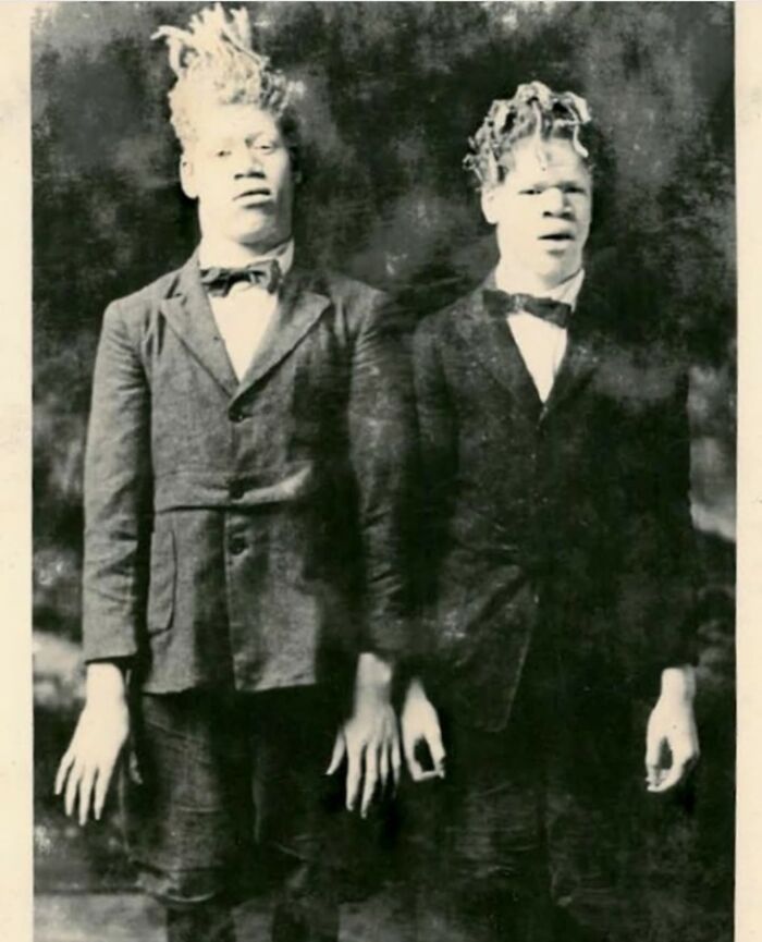 Billed As "The Sheep-Headed Men," "The White Ecuadorian Cannibals Eko And Iko," And "The Ambassadors From Mars,” George And Willie Muse Were World-Famous Sideshow Performers In The Early 1900s
