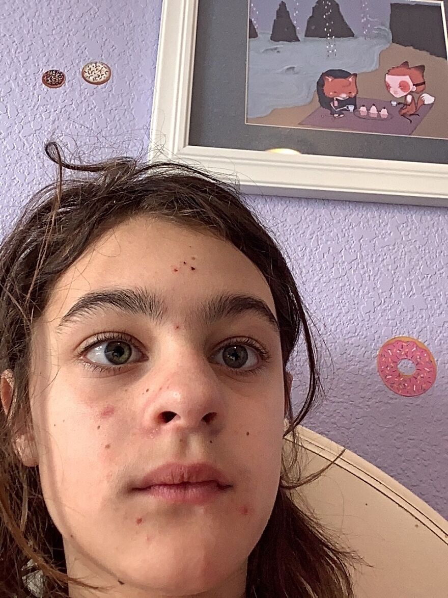 I Know It’s A Horrible Picture But Those Are My Eyes