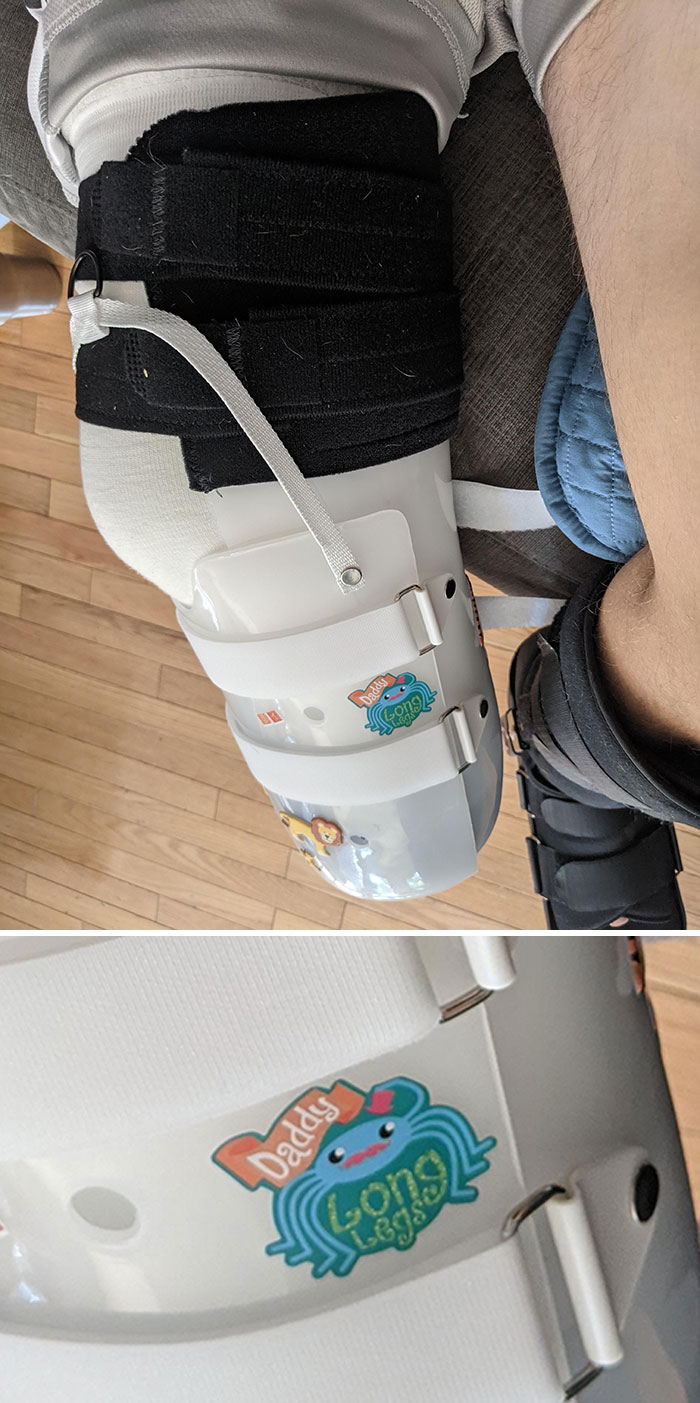 Just Lost My Foot After A Motorcycle Accident. This Is The Sticker My Son Chose To Decorate My Brace