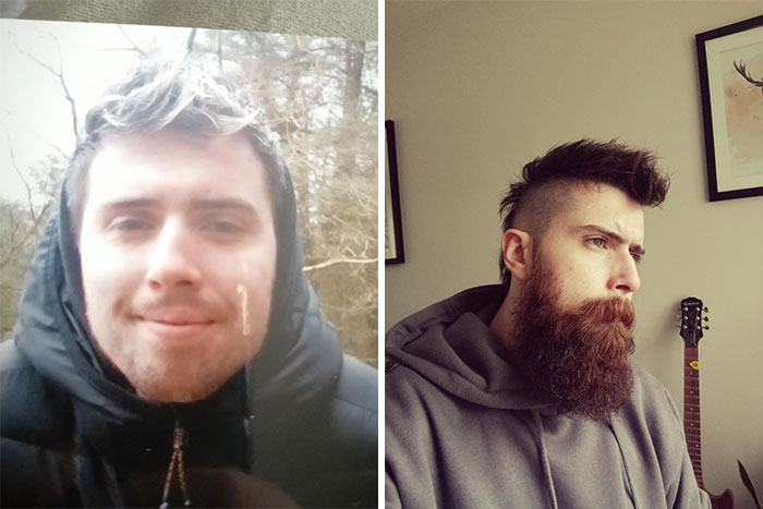 My First Beard. Hard To Tell From The Last Pic But I Actually Don't Have Great Coverage At All, Very Patchy. Took A Lot Of Patience And Bad Days To Get Here