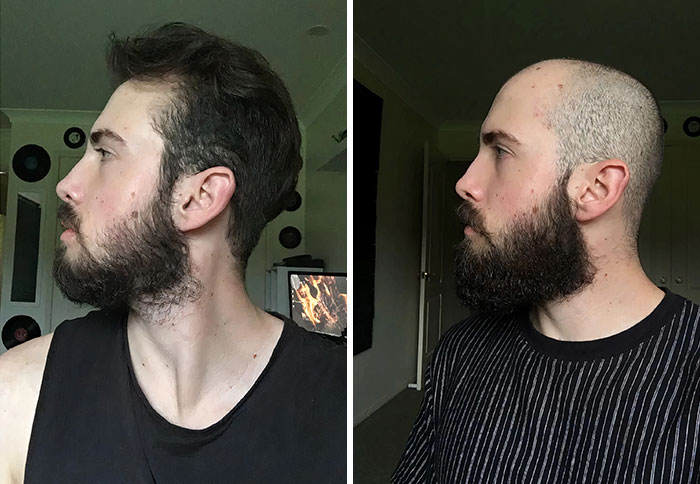 Both Photos Taken 2 Months Into Growing A Beard A Year Apart