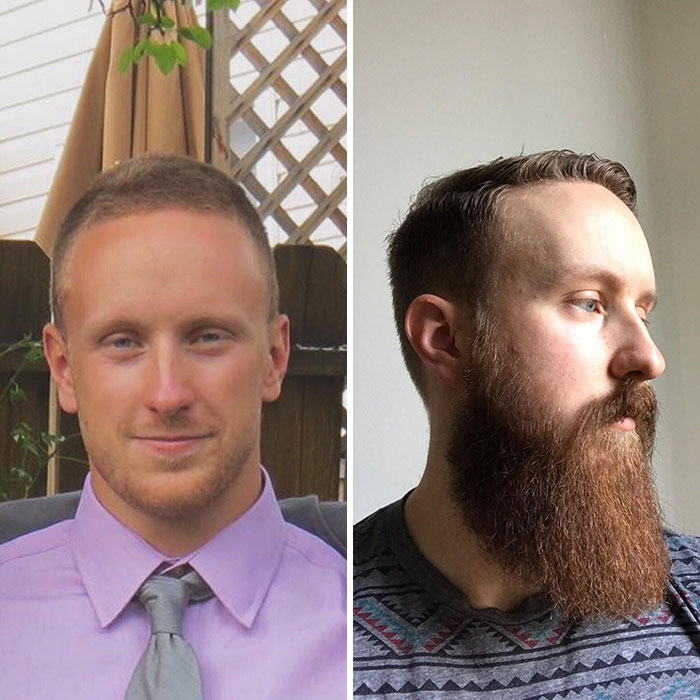 10 Months Beard Progress, Trimming Every 3-6 Weeks