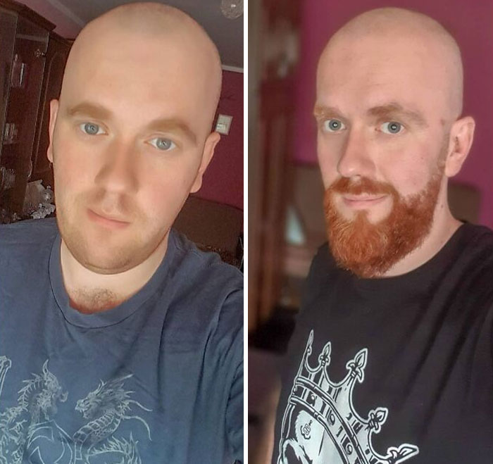 With Or Without Beard?