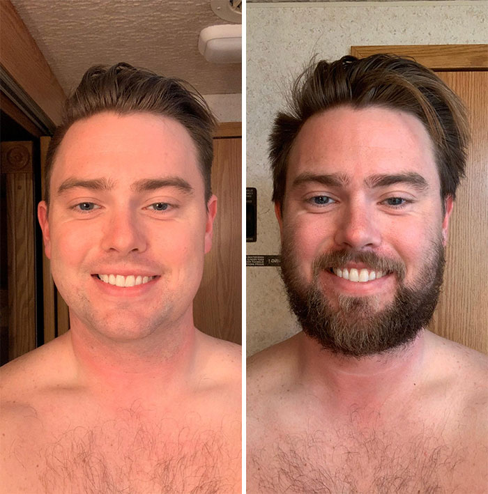 Finally Out Of The Military After 6 Years. Couldn’t Wait For This. 2 Month Progress, 26 Years Old