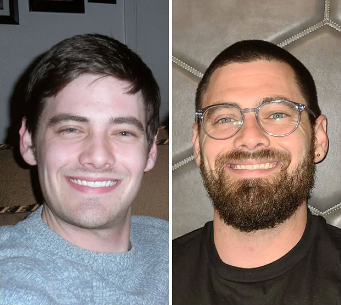 Beardless And Beard Challenge Accepted 2010 vs. 2020
