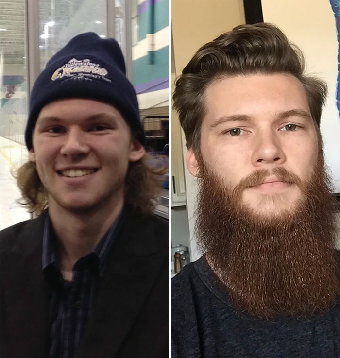 2014 On The Left 19 Years Old. 2020 On The Right 26 Years Old. About 10.5 Months Of Beard Growth Out Of My Year Long Journey