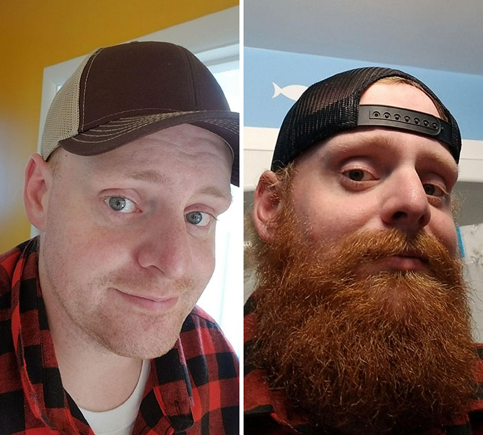 Officially Six Months. Side By Side For Comparison