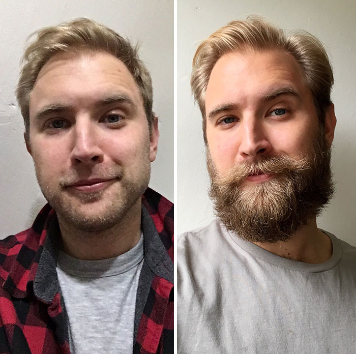 3-Month Beard Progress