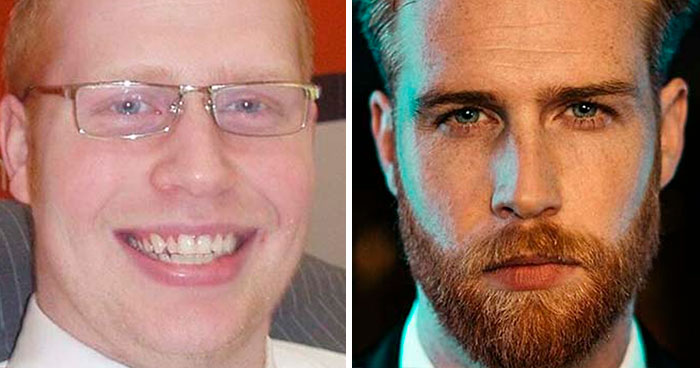 25 Hombres que ahora lucen su barba comparten su aspecto anterior