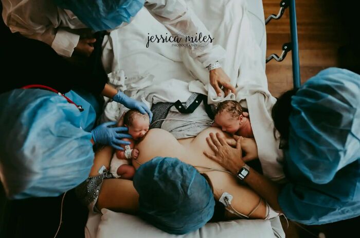 Mejor fotografía en la categoría “Posparto”: “La primera lactancia de los gemelos” por Jessica Miles, Estados Unidos