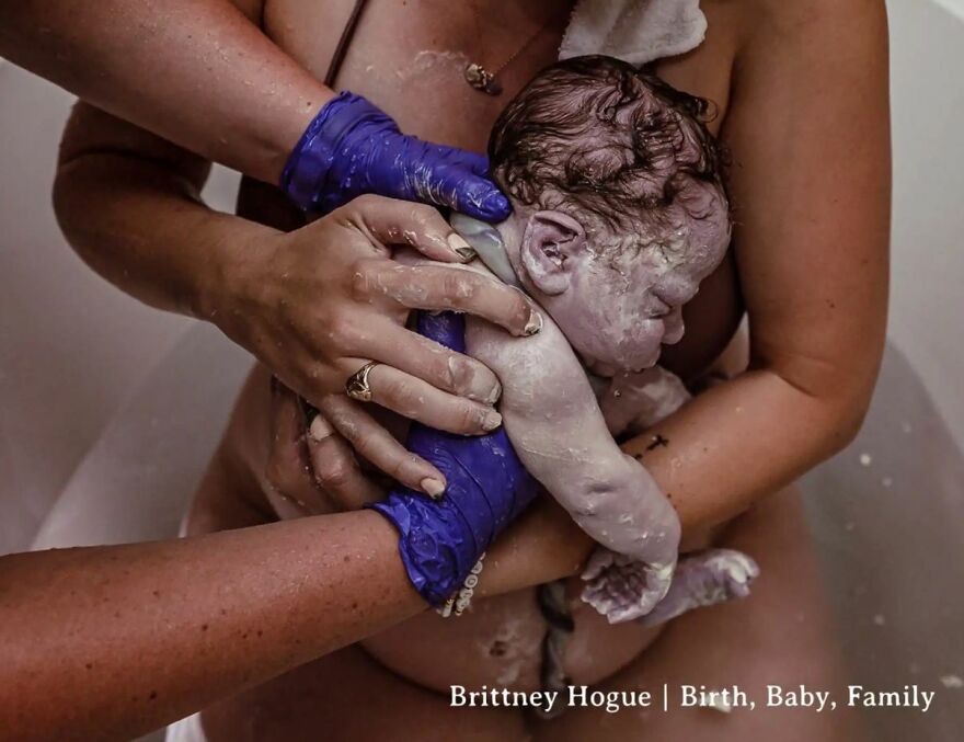 Best In Birth Details: “Nuchal" By Brittney Hogue, United States