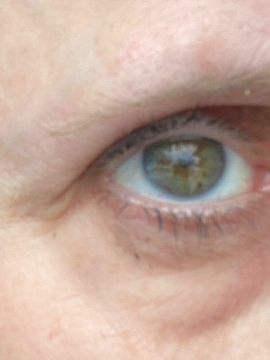 My Hazel Eye