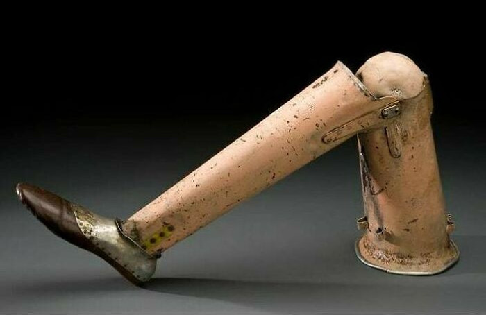 Artificial Leg Made Out Of The Fuselage Of A Crashed Plane
