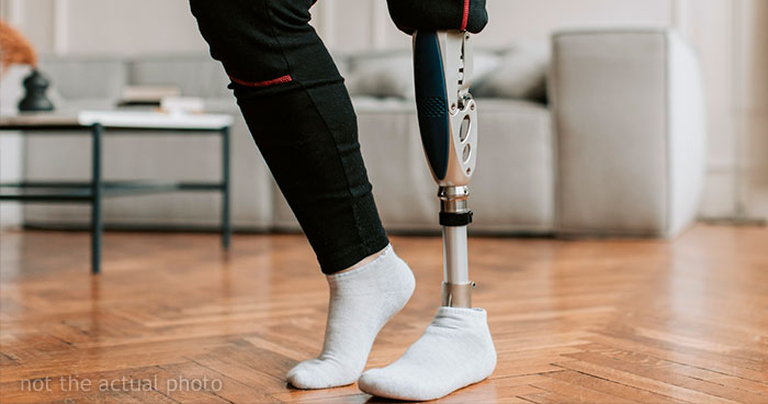 “I Took My Leg Off”: Woman Asks If She Was Wrong To Dramatically Respond To This Man Who Yelled At Her For Parking In A Handicapped Spot