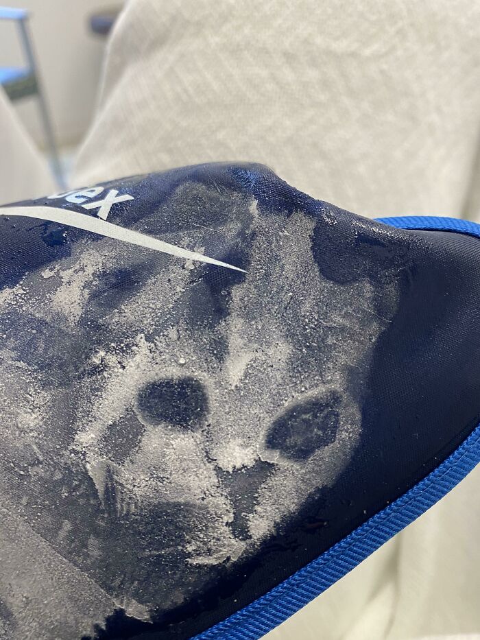 The Frost On My Ice Glove Looks Like A Cat