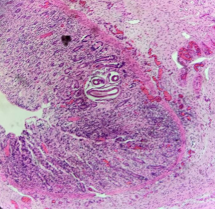 This Cross Section Of A Parasitic Worm Looks Exactly Like Pepe The Frog