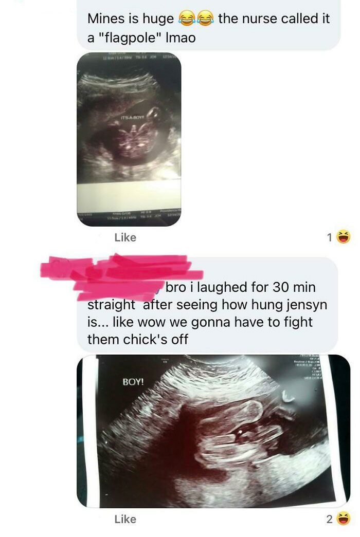 Moms Trying To One Up Each Other By Comparing The Size Of Their Babies’ Penises In Their Ultrasounds