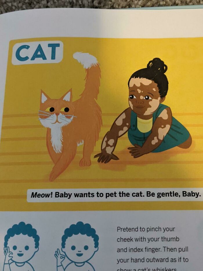 This Book Uses A Drawing Of A Baby With Vitiligo