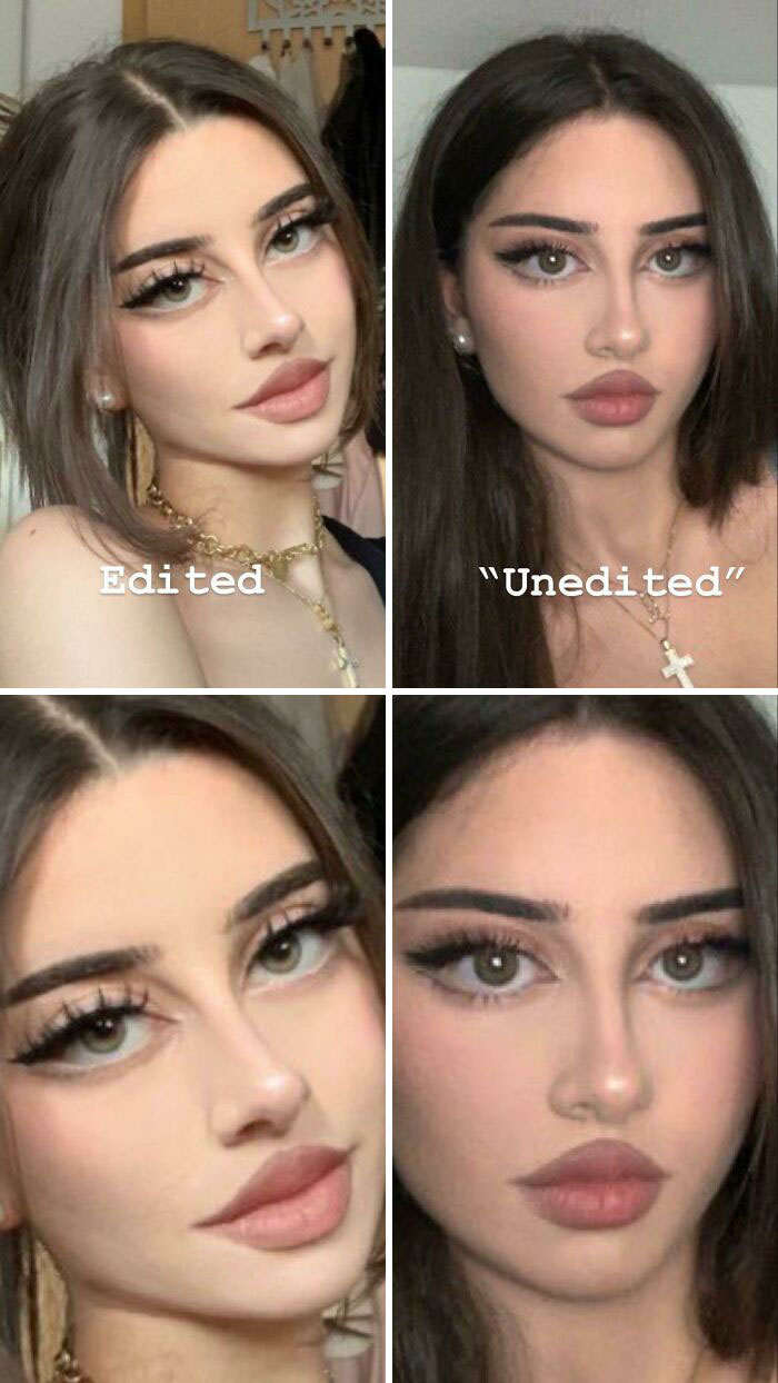 Girl Posts Photo With Filter (Left) And Without (Right) After People Commenting Her Eyes Look Unnatural