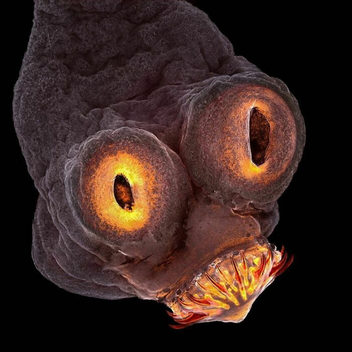 This Guy Says Hi. He’s Mr. Tapeworm And He Had His Photo Taken With A Microscope. Look At That Toothy Smile