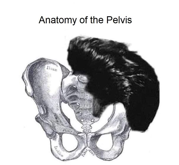 Pelvis-6247d5d0413cf.jpg