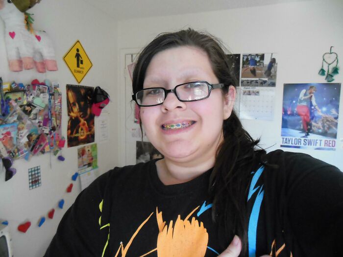 Me At 15 (2013), When I Thought It Was Cool To Shave My Eyebrows Off. Also, Those Braces Are Fake 