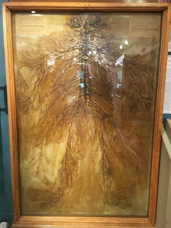 Este es un sistema nervioso humano intacto que fue diseccionado por dos estudiantes de medicina en 1925. Les llevó más de 1500 horas. Solo hay 4 de estos en el mundo.