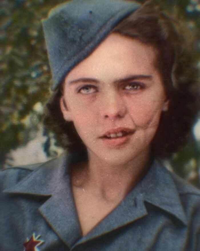 Albina Mali-Hočevar Was A Slovenian Fighter Who Was Wounded In Combat Several Times During Ww2