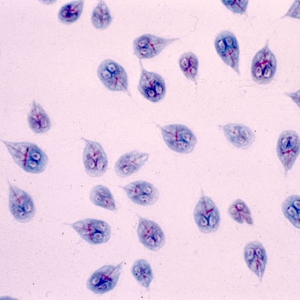 Giardia-under-microscope-628d1eb632ffd.jpg
