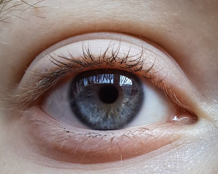Here Is My Eye! I'm Not Entirely Sure If It Is Blue, Gray Or Hazel