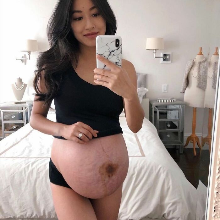 30 Mothers Are Sharing Realistic Pictures Of Baby Bumps And Pregnant Bodies To Fight Toxic Standards