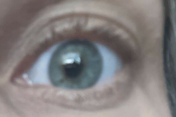 Didn't Realize It Was Difficult To Take A Pic Of Your Own Eye