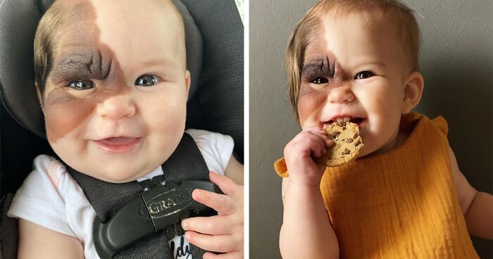 Mom Shares Her Daughter’s Unique Birthmark, Gathering 300k Followers Supporting Their Journey