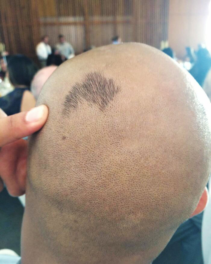 I Missed A Little Patch Of Hair While Shaving The Back Of Steven's Head. I Didn't Notice It Until Tonya's Wedding Reception. Everyone Had Already Seen It
