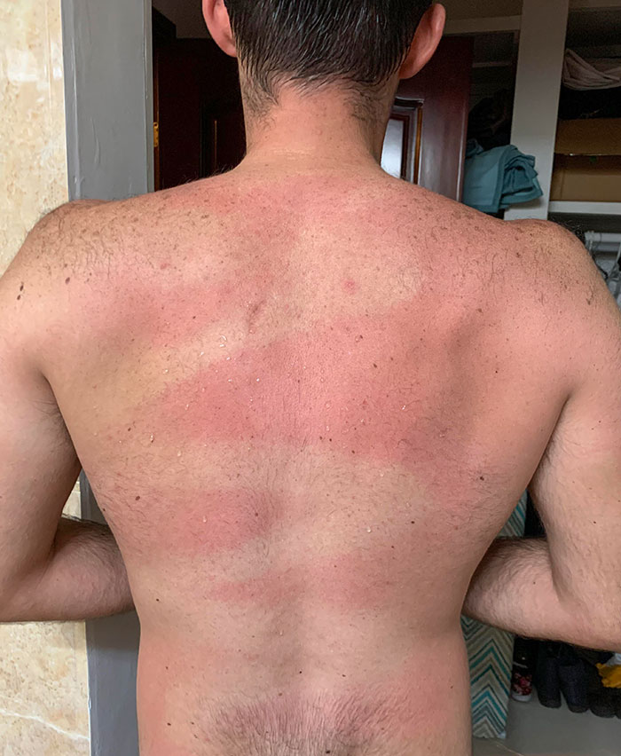 Wife Helped Spray Sunscreen On My Back