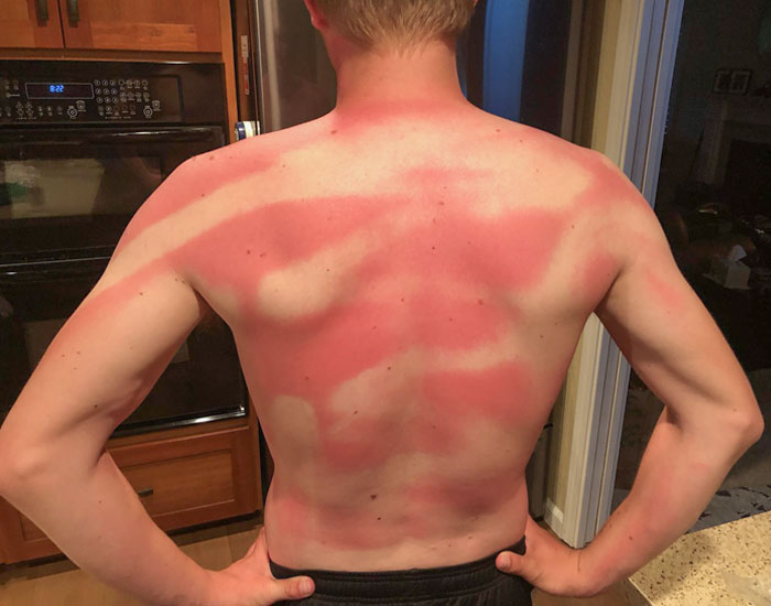 My Wife Helped Me Sunscreen My Back At Beach Day Today. Twice