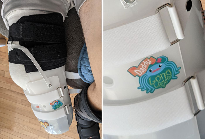 Just Lost My Foot After A Motorcycle Accident. This Is The Sticker My Son Chose To Decorate My Brace