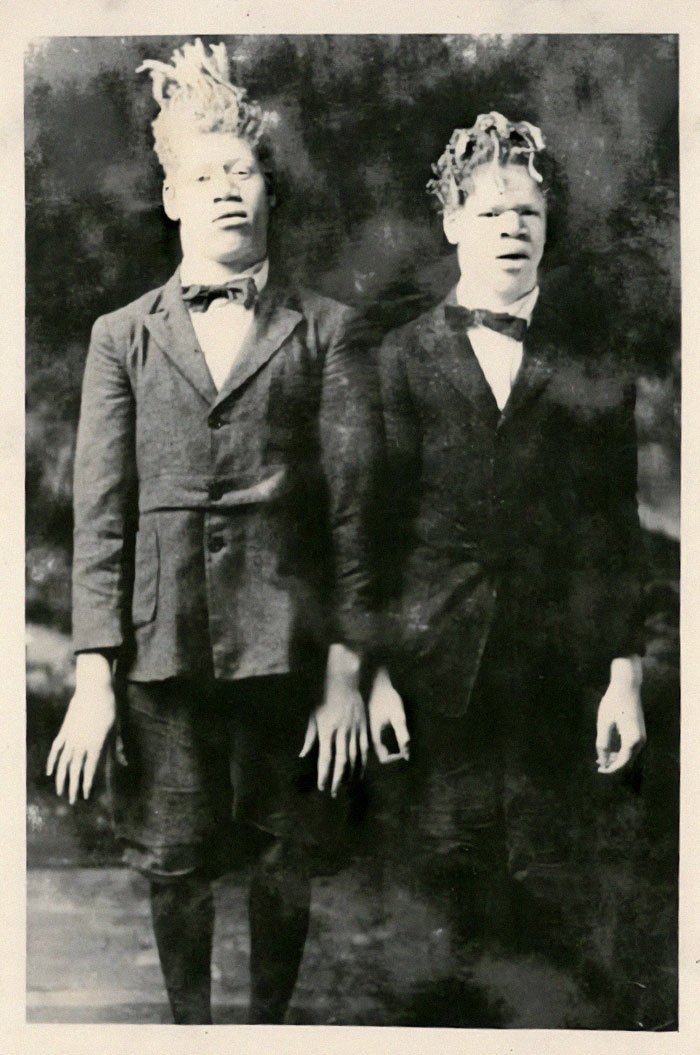 Billed As "The Sheep-Headed Men," "The White Ecuadorian Cannibals Eko And Iko," And "The Ambassadors From Mars,” George And Willie Muse Were World-Famous Sideshow Performers In The Early 1900s. But Even Their White Audiences Hardly Knew The Horrors Of Their Story