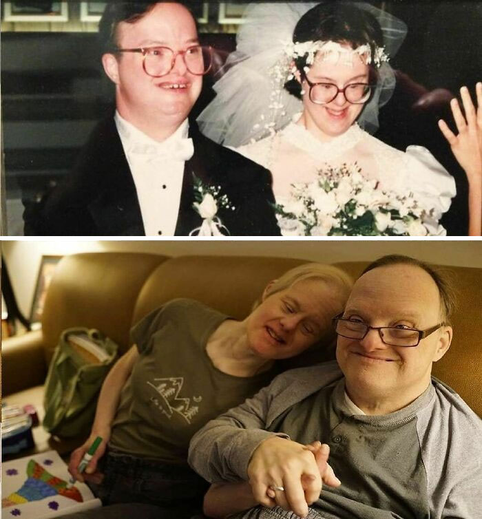 Ris Scharoun-Deforge And Paul Deforge, A Couple With Down Syndrome Who Celebrated Their 25th Wedding Anniversary On August 13, 2018