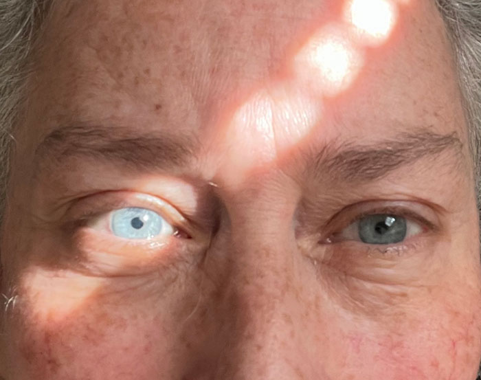 What The Sunlight Did